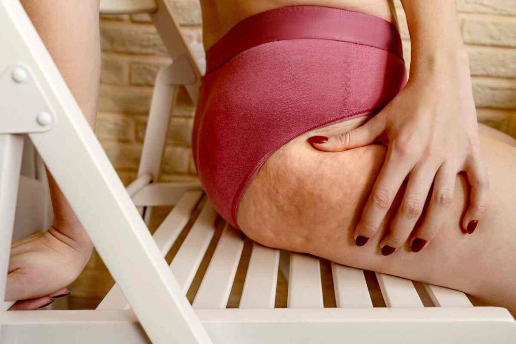 cellulite: scopri come la pianta di equiseto può aiutarti
