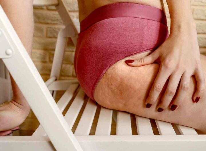 cellulite: scopri come la pianta di equiseto può aiutarti