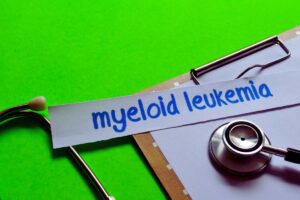 Leucemia mieloide: i segreti della diagnosi precoce